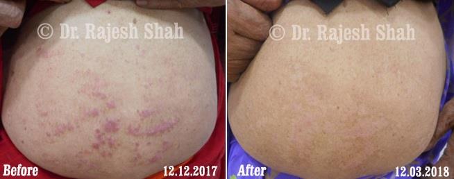 lifeforce homeopathy case-photos